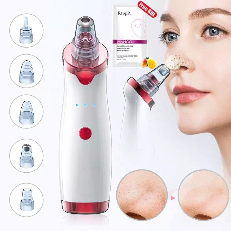 Opal Blackhead remover