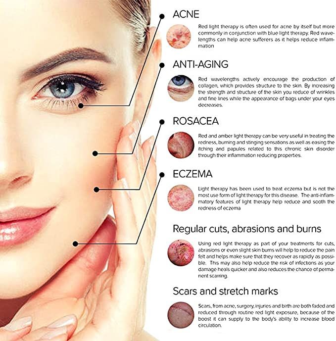 Opal High-Frequency Comb