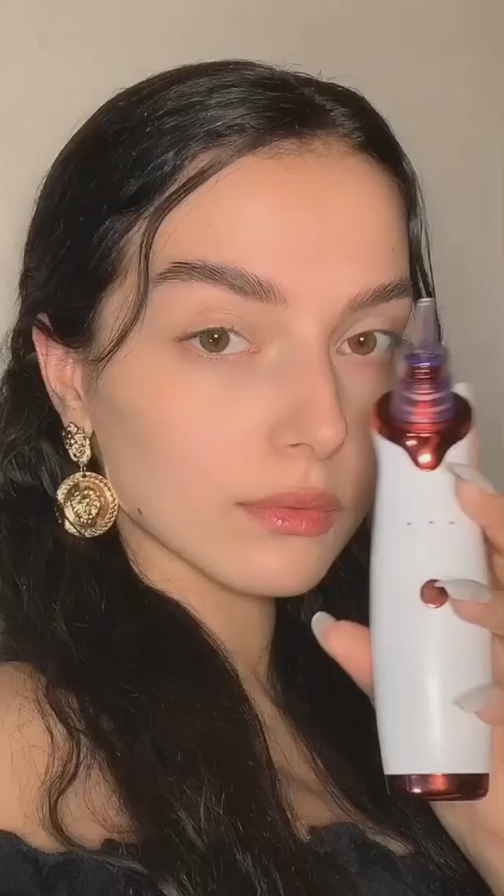 Opal Blackhead remover