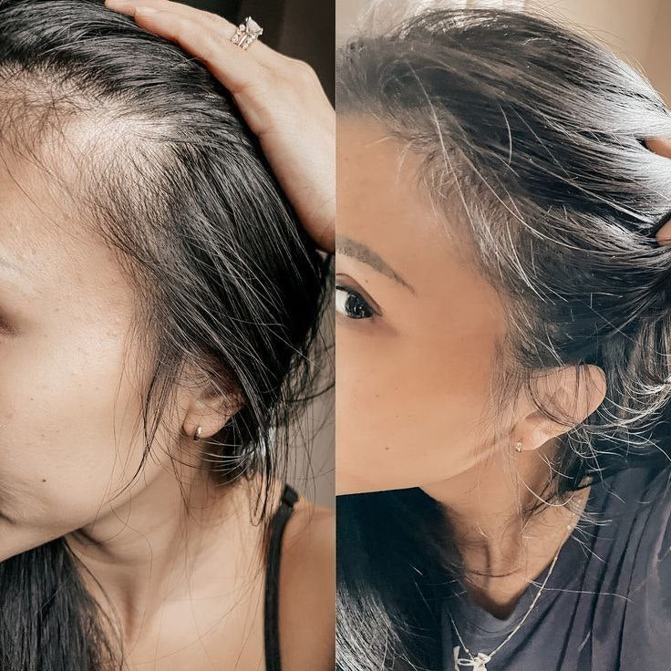 2025 Opal Oil massage comb