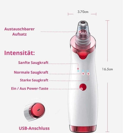 Opal Blackhead remover