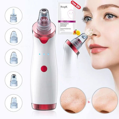 Opal Blackhead remover