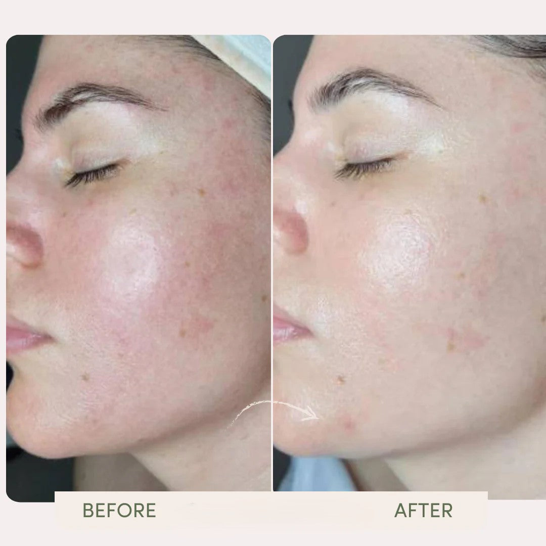 Opal Hailicare Facial Cleansing &amp; Lifting