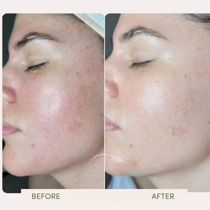 Opal Hailicare Facial Cleansing &amp; Lifting