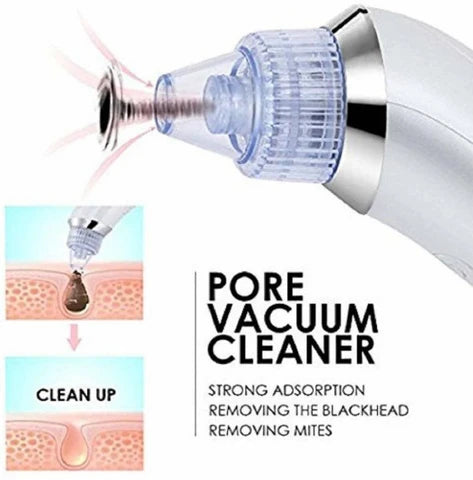 Blackhead Remover Pore Vacuum Cleaner